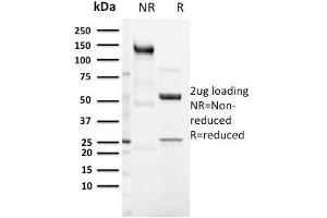 SDS-PAGE Analysis Purified CD3e Rabbit Recombinant Monoclonal Antibody (C3e/3125R). (Recombinant CD3 epsilon anticorps  (AA 23-119))