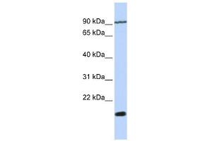 TM4SF4 antibody used at 1 ug/ml to detect target protein. (TM4SF4 anticorps  (N-Term))