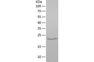 Western Blotting (WB) image for Proline Rich 13 (PRR13) (AA 1-148) protein (His tag) (ABIN7124592)