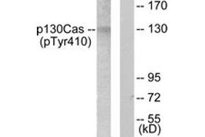 Western blot analysis of extracts from NIH-3T3 cells, using p130 Cas (Phospho-Tyr410) Antibody.