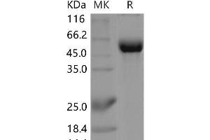 Western Blotting (WB) image for CD22 Molecule (CD22) protein (Fc Tag) (ABIN7320025) (CD22 Protein (Fc Tag))