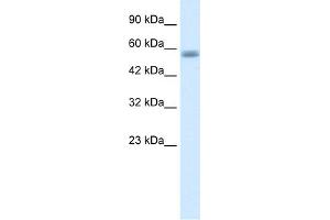 WB Suggested Anti-C16ORF44 Antibody Titration:  1. (KLHL36 anticorps  (N-Term))