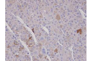 IHC-P Image Immunohistochemical analysis of paraffin-embedded human adrenal gland tumor, using FBXO2, antibody at 1:100 dilution.