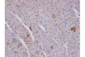 IHC-P Image Immunohistochemical analysis of paraffin-embedded human adrenal gland tumor, using FBXO2, antibody at 1:100 dilution.