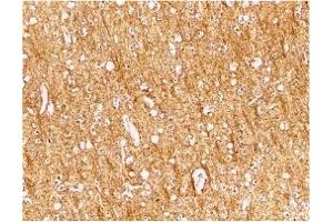 Immunohistochemistry (IHC) image for anti-ATR serine/threonine kinase (ATR) (Middle Region) antibody (ABIN1030871) (ATR anticorps  (Middle Region))