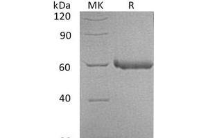 Western Blotting (WB) image for Lymphocyte-Activation Gene 3 (LAG3) (Active) protein (His tag) (ABIN7320943)
