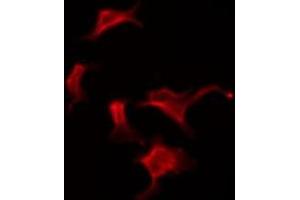 ABIN6276069 staining HuvEc by IF/ICC. (OR10G2 anticorps)