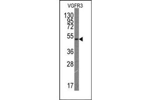 Western Blotting (WB) image for anti-Fms-Related Tyrosine Kinase 4 (FLT4) antibody (ABIN356407) (FLT4 anticorps)