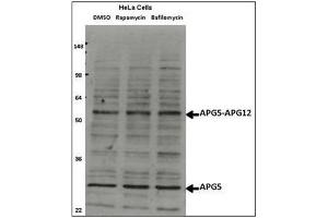 Western blot analysis of ATG5 Antibody (N-term) in Hela cell lysates, which were treated with rapamycin or bafilomycin overnight.