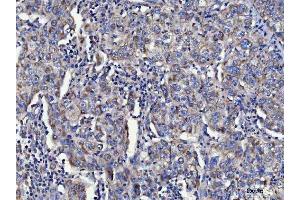 IHC analysis of TOLLIP using anti-TOLLIP antibody (ABIN7599202). (TOLLIP anticorps  (AA 1-274))