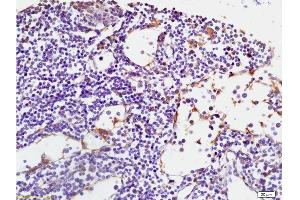 Formalin-fixed and paraffin embedded human spleen tissue labeled with Anti-RANK/CD265 Polyclonal Antibody, Unconjugated at 1:200 followed by conjugation to the secondary antibody, (SP-0023), and DAB staining