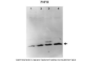 Lanes:   1. (PHF19 anticorps  (C-Term))