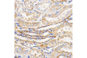 Immunohistochemistry of paraffin-embedded Mouse kidney using Mitofusin 2 Rabbit pAb (ABIN6133825, ABIN6143800, ABIN6143803 and ABIN6216518) at dilution of 1:100 (40x lens).