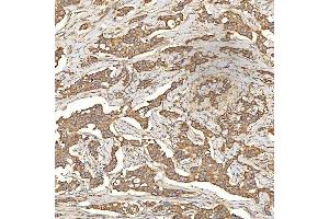 IHC analysis of Citrin/SLC25A13 using anti-Citrin/SLC25A13 antibody (ABIN7599512). (slc25a13 anticorps  (AA 1-643))