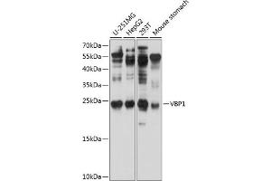 Western blot analysis of extracts of various cell lines, using VBP1 antibody (ABIN6129700, ABIN6150068, ABIN6150069 and ABIN6224846) at 1:1000 dilution. (VBP1 anticorps  (AA 1-197))