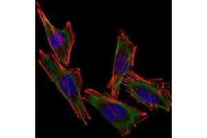 Confocal Immunofluorescent analysis of A2058 cells using CF488-labeled S100B Monoclonal Antibody (S100B/1012) (Green). (S100B anticorps  (CF®488A))