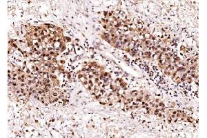 IHC analysis of Aurora A/AURKA using anti-Aurora A/AURKA antibody (ABIN7599581). (Aurora A anticorps  (AA 1-97))