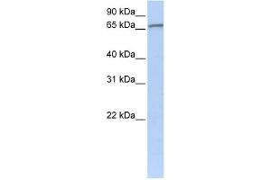 WB Suggested Anti-ZNF41 Antibody Titration:  0. (ZNF41 anticorps  (C-Term))