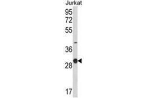 Western blot analysis of KLRC1 Antibody (C-term) in Jurkat cell line lysates (35ug/lane). (KLRC1 anticorps  (C-Term))