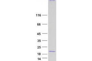 Validation with Western Blot