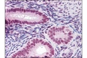 Immunohistochemistry (IHC) image for anti-Runt-Related Transcription Factor 2 (RUNX2) (AA 251-351) antibody (ABIN614560)