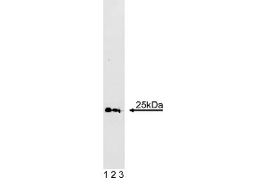Western Blotting (WB) image for anti-RAB5A, Member RAS Oncogene Family (RAB5A) (AA 1-215) antibody (ABIN967882) (RAB5 anticorps  (AA 1-215))