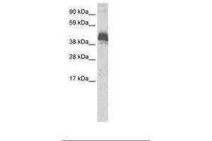 Image no. 1 for anti-Zinc Finger and BTB Domain Containing 43 (ZBTB43) (AA 188-237) antibody (ABIN6736063) (ZBTB43 anticorps  (AA 188-237))