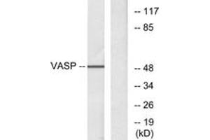 Western blot analysis of extracts from NIH-3T3 cells, treated with forskolin 40myM 30', using VASP (Ab-157) Antibody. (VASP anticorps  (AA 124-173))