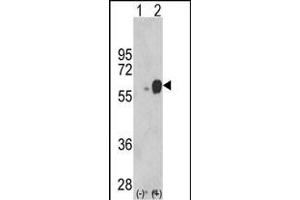 Western blot analysis of ARSB (arrow) using rabbit polyclonal ARSB Antibody (Center) (ABIN652346 and ABIN2841582). (Arylsulfatase B anticorps  (AA 235-266))