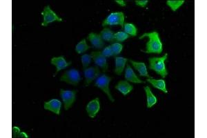 Immunofluorescence staining of A549 cells with ABIN7153457 at 1:50, counter-stained with DAPI.
