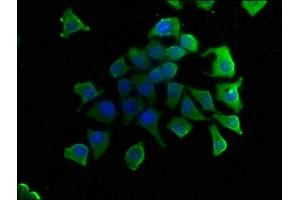 Immunofluorescence staining of A549 cells with ABIN7153457 at 1:50, counter-stained with DAPI. (GAL4 anticorps  (AA 1-323))