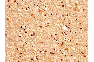 IHC image of ABIN7160347 diluted at 1:400 and staining in paraffin-embedded human brain tissue performed on a Leica BondTM system. (CHRM3 anticorps  (AA 253-492))