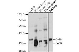Western blot analysis of extracts of various cell lines, using CB antibody (ABIN7266072) at 1:1000 dilution.