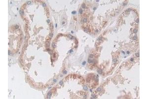 Detection of ABCA3 in Human Kidney Tissue using Polyclonal Antibody to ATP Binding Cassette Transporter A3 (ABCA3)