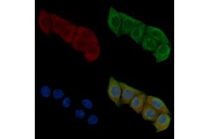ABIN6259466 and ABIN6275441 staining Hela cells(45 min of heat-shock) by IF/ICC. (RFTN1 anticorps  (Internal Region))