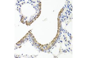 Immunohistochemistry of paraffin-embedded mouse lung using TTR antibody (ABIN3021473, ABIN3021474, ABIN3021475 and ABIN6215107) at dilution of 1:100 (40x lens). (TTR anticorps  (AA 21-147))