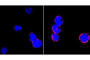 Confocal immunofluorescence analysis of BCBL-1 cells (left) and L1210 cells (right) using CD18 mouse mAb (red). (Integrin beta 2 anticorps)