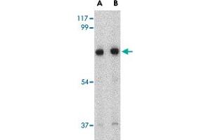 Western blot analysis of HAP1 in mouse brain tissue lysate with HAP1 polyclonal antibody  at (A) 0. (HAP1 anticorps  (Internal Region))