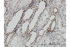 Immunoperoxidase of monoclonal antibody to DCPS on formalin-fixed paraffin-embedded human kidney. (DCPS anticorps  (AA 1-337))
