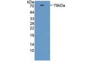 Detection of Recombinant ZPI, Human using Polyclonal Antibody to Serpin A10 (SERPINA10) (SERPINA10 anticorps  (AA 24-444))