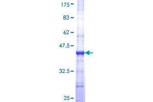 Image no. 1 for Plasmalemma Vesicle Associated Protein (PLVAP) (AA 51-150) protein (GST tag) (ABIN1315485)