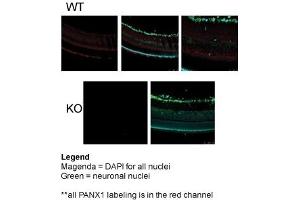 Sample Type: Mouse Retina and Knockout PANX-1 Mouse Tissue