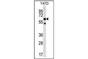 Western blot analysis of SCP2 Antibody (N-term) Cat.