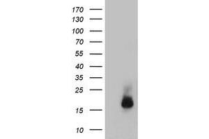 Image no. 1 for anti-Cystatin C (CST3) antibody (ABIN1497754) (CST3 anticorps)
