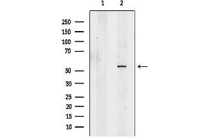 anti-Calcium Binding tyrosine-(Y)-phosphorylation Regulated (CABYR) (Internal Region) antibody