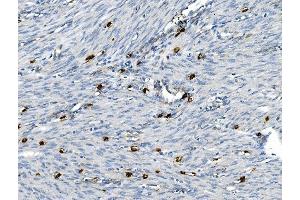 IHC analysis of CD30/TNFRSF8 using anti-CD30/TNFRSF8 antibody (ABIN7603165).