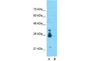 Host:  Rabbit  Target Name:  LDHB  Sample Type:  Human Fetal Lung  Lane A:  Primary Antibody  Lane B:  Primary Antibody + Blocking Peptide  Primary Antibody Concentration:  1ug/ml  Peptide Concentration:  5ug/ml  Lysate Quantity:  25ug/lane/lane  Gel Concentration:  0.