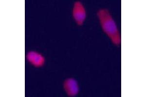 Immunofluorecence staining of GPC3 polyclonal antibody  on HepG2 cells . (Glypican 3 anticorps  (Internal Region))