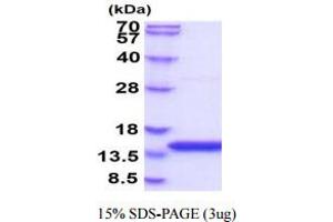 SDS-PAGE (SDS) image for Cystatin B (Stefin B) (CSTB) (AA 1-98) protein (His tag) (ABIN666707)