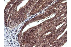Image no. 4 for anti-D-Dopachrome Tautomerase (DDT) antibody (ABIN1497795)